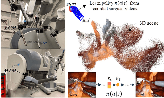 Figure 1 for 3D Perception based Imitation Learning under Limited Demonstration for Laparoscope Control in Robotic Surgery