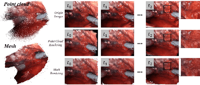 Figure 3 for 3D Perception based Imitation Learning under Limited Demonstration for Laparoscope Control in Robotic Surgery