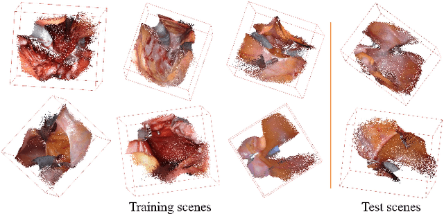 Figure 4 for 3D Perception based Imitation Learning under Limited Demonstration for Laparoscope Control in Robotic Surgery