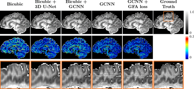 Figure 2 for Multifold Acceleration of Diffusion MRI via Slice-Interleaved Diffusion Encoding (SIDE)