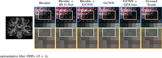 Figure 3 for Multifold Acceleration of Diffusion MRI via Slice-Interleaved Diffusion Encoding (SIDE)