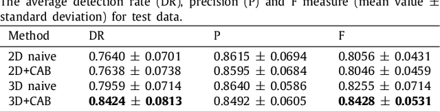 Figure 4 for Sequential vessel segmentation via deep channel attention network