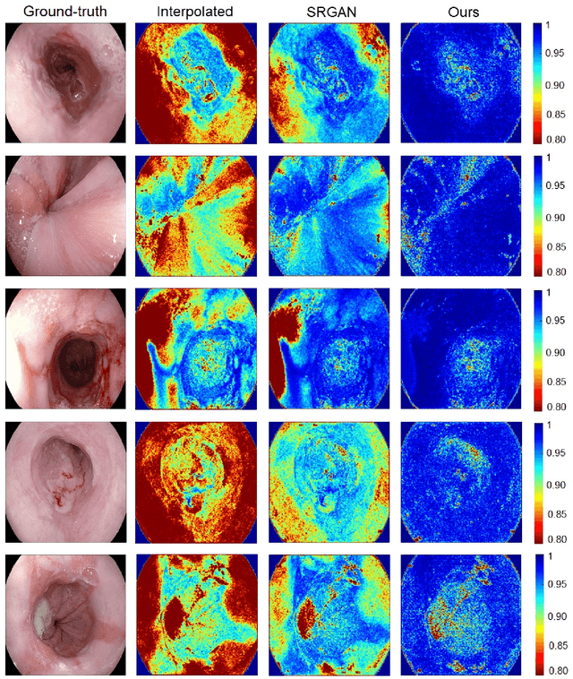 Figure 2 for EndoL2H: Deep Super-Resolution for Capsule Endoscopy