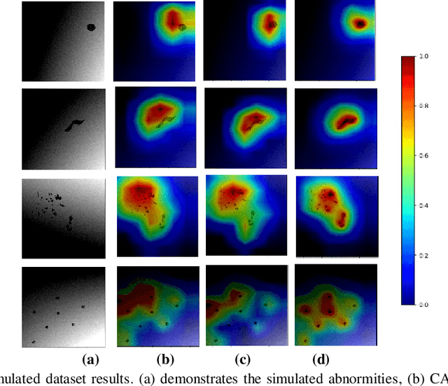 Figure 3 for HR-CAM: Precise Localization of Pathology Using Multi-level Learning in CNNs