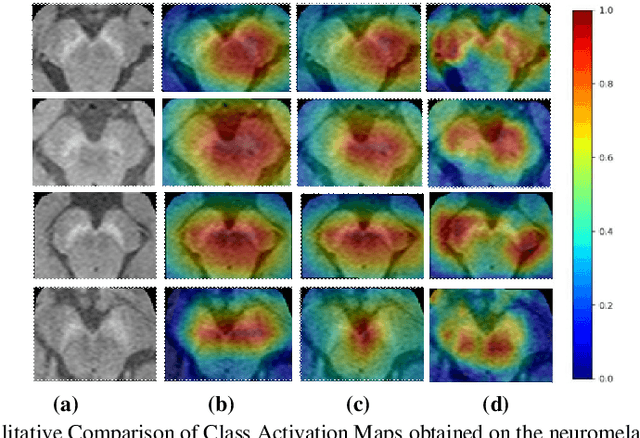Figure 4 for HR-CAM: Precise Localization of Pathology Using Multi-level Learning in CNNs