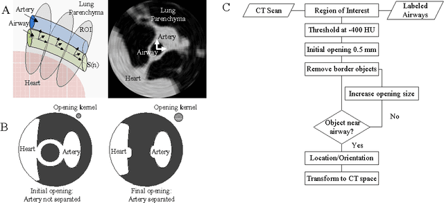 Figure 3 for Automated segmentation of the pulmonary arteries in low-dose CT by vessel tracking