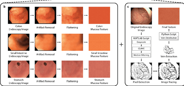 Figure 2 for VR-Caps: A Virtual Environment for Capsule Endoscopy