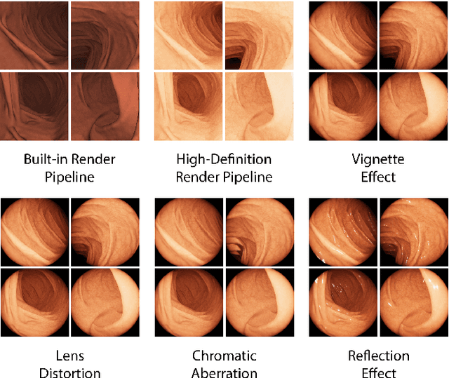 Figure 3 for VR-Caps: A Virtual Environment for Capsule Endoscopy