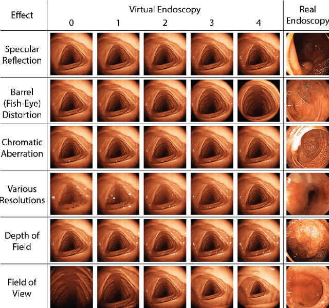 Figure 4 for VR-Caps: A Virtual Environment for Capsule Endoscopy