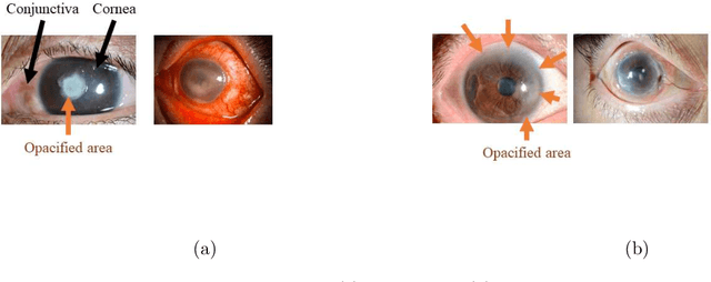 Figure 1 for Automated eye disease classification method from anterior eye image using anatomical structure focused image classification technique