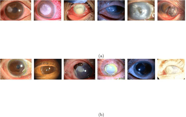 Figure 3 for Automated eye disease classification method from anterior eye image using anatomical structure focused image classification technique