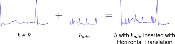 Figure 3 for Application of Adversarial Examples to Physical ECG Signals
