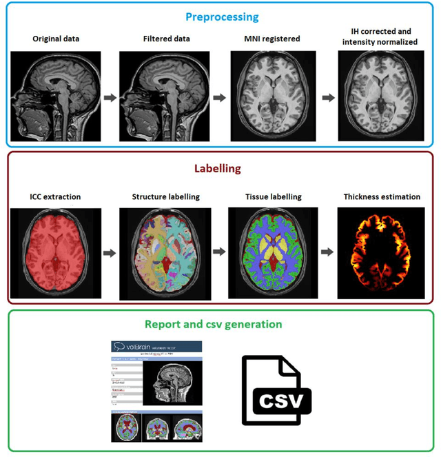 Figure 4 for vol2Brain: A new online Pipeline for whole Brain MRI analysis