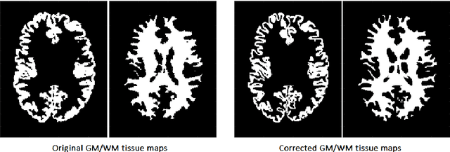 Figure 1 for vol2Brain: A new online Pipeline for whole Brain MRI analysis