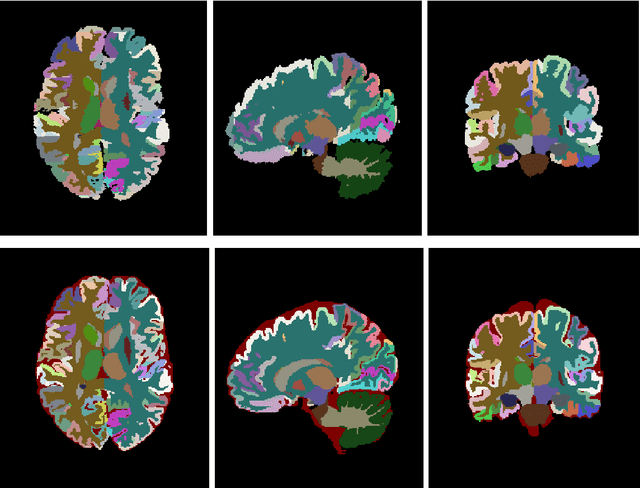 Figure 3 for vol2Brain: A new online Pipeline for whole Brain MRI analysis
