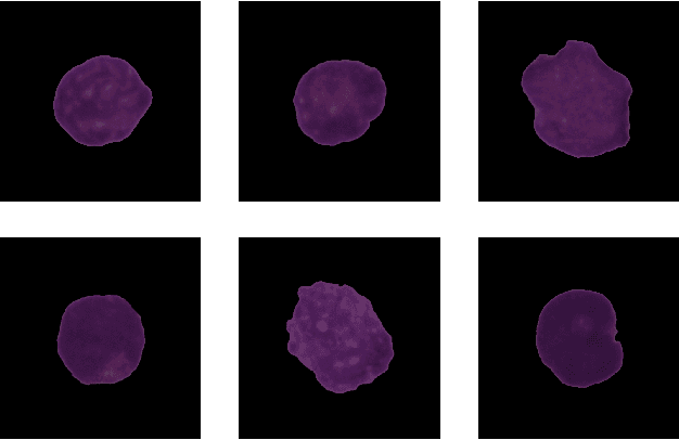 Figure 1 for A Hybrid Deep Learning Architecture for Leukemic B-lymphoblast Classification