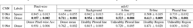 Figure 2 for Dense Pixel-Labeling for Reverse-Transfer and Diagnostic Learning on Lung Ultrasound for COVID-19 and Pneumonia Detection