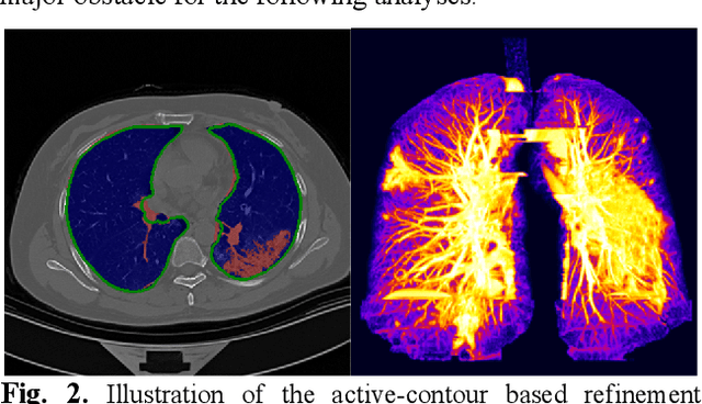 Figure 3 for COVID-MTL: Multitask Learning with Shift3D and Random-weighted Loss for Diagnosis and Severity Assessment of COVID-19