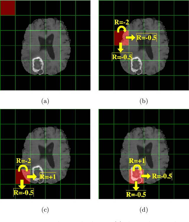 Figure 1 for Reinforcement learning using Deep Q Networks and Q learning accurately localizes brain tumors on MRI with very small training sets