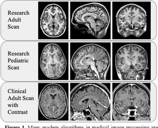Figure 1 for Generalizing Deep Whole Brain Segmentation for Pediatric and Post-Contrast MRI with Augmented Transfer Learning