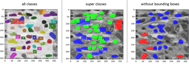 Figure 4 for Nucleus Segmentation and Analysis in Breast Cancer with the MIScnn Framework