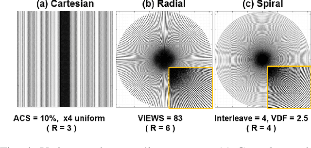 Figure 4 for k-Space Deep Learning for Accelerated MRI