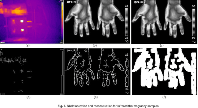 Figure 4 for Skeletonization and Reconstruction based on Graph Morphological Transformations