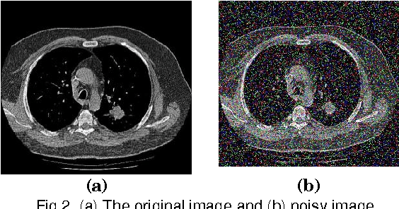 Figure 3 for Soft Set Based Feature Selection Approach for Lung Cancer Images