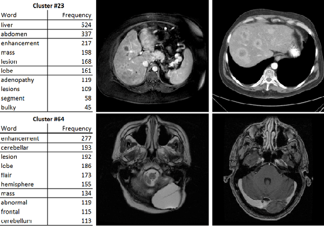 Figure 3 for Unsupervised Joint Mining of Deep Features and Image Labels for Large-scale Radiology Image Categorization and Scene Recognition