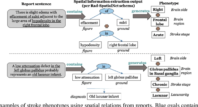 Figure 1 for Leveraging Spatial Information in Radiology Reports for Ischemic Stroke Phenotyping