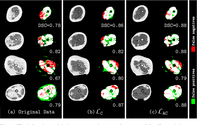 Figure 4 for An Asymetric Cycle-Consistency Loss for Dealing with Many-to-One Mappings in Image Translation: A Study on Thigh MR Scans