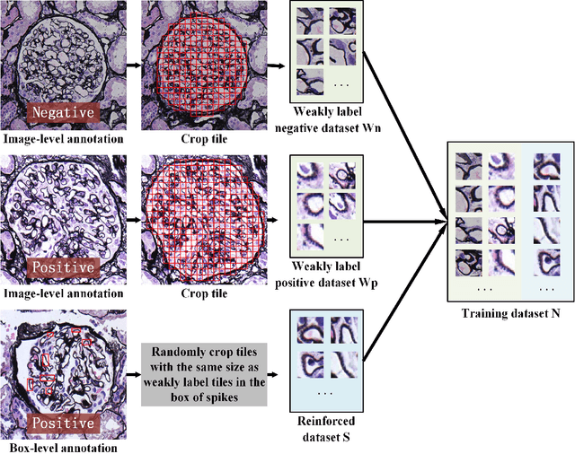 Figure 3 for MSA-MIL: A deep residual multiple instance learning model based on multi-scale annotation for classification and visualization of glomerular spikes