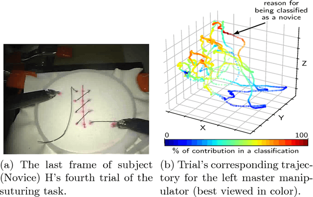 Figure 3 for Evaluating surgical skills from kinematic data using convolutional neural networks