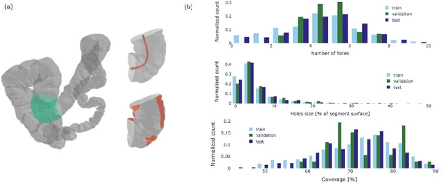 Figure 3 for Estimating the coverage in 3d reconstructions of the colon from colonoscopy videos