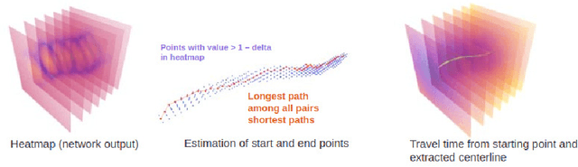 Figure 4 for Estimating the coverage in 3d reconstructions of the colon from colonoscopy videos