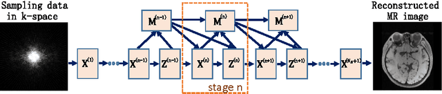 Figure 1 for ADMM-Net: A Deep Learning Approach for Compressive Sensing MRI