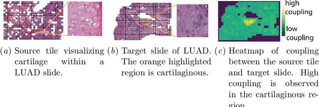Figure 2 for Hierarchical Optimal Transport for Comparing Histopathology Datasets