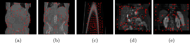 Figure 4 for Driving Points Prediction For Abdominal Probabilistic Registration
