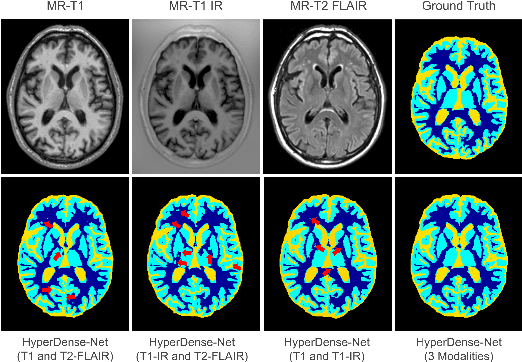 Figure 3 for HyperDense-Net: A hyper-densely connected CNN for multi-modal image segmentation