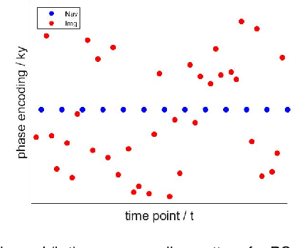 Figure 1 for Accelerated partial separable model using dimension-reduced optimization technique for ultra-fast cardiac MRI