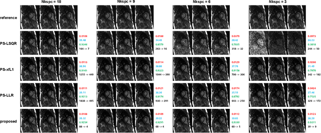 Figure 3 for Accelerated partial separable model using dimension-reduced optimization technique for ultra-fast cardiac MRI