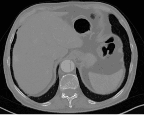 Figure 1 for Design and Development of a Web-based Tool for Inpainting of Dissected Aortae in Angiography Images