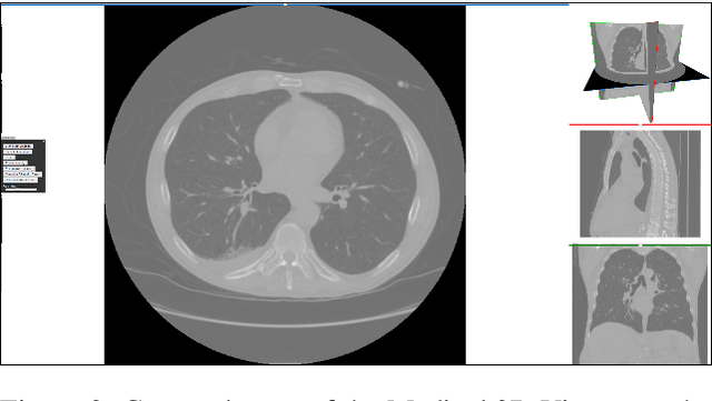 Figure 2 for Design and Development of a Web-based Tool for Inpainting of Dissected Aortae in Angiography Images