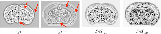 Figure 4 for Towards ultra-high resolution 3D reconstruction of a whole rat brain from 3D-PLI data