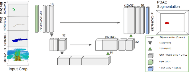 Figure 3 for Improved Pancreatic Tumor Detection by Utilizing Clinically-Relevant Secondary Features