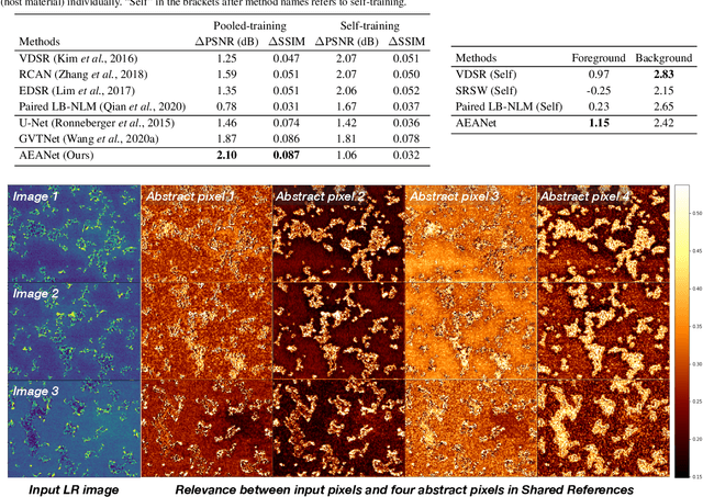 Figure 2 for Augmented Equivariant Attention Networks for Electron Microscopy Image Super-Resolution