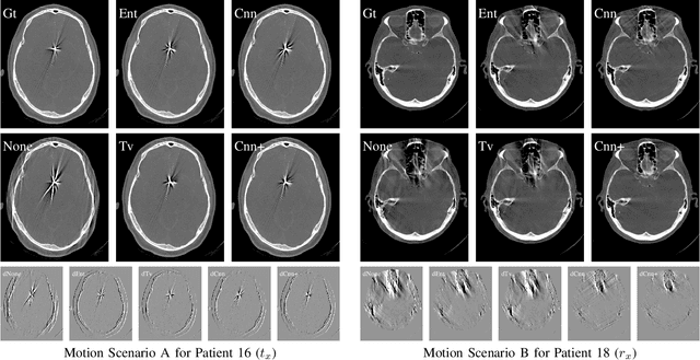 Figure 2 for Appearance Learning for Image-based Motion Estimation in Tomography