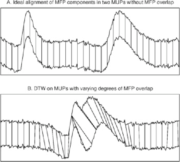 Figure 3 for Affine and Regional Dynamic Time Warpng