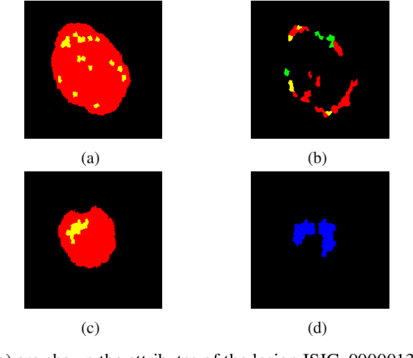 Figure 3 for Segmentation of skin lesions and their attributes using Generative Adversarial Networks