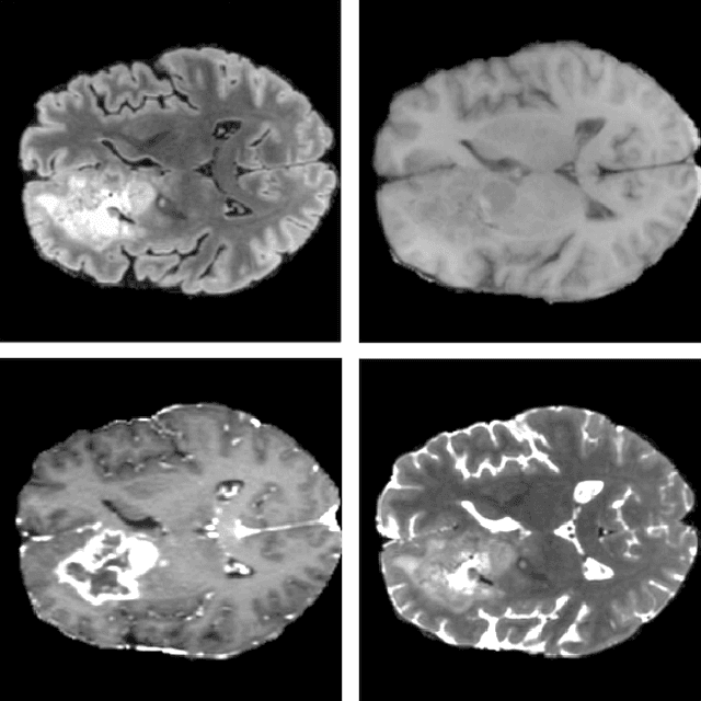 Figure 1 for Optimized U-Net for Brain Tumor Segmentation